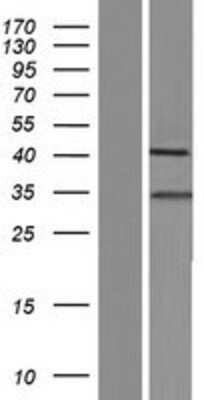 Western Blot: SHOX2 Overexpression Lysate [NBP2-10141]