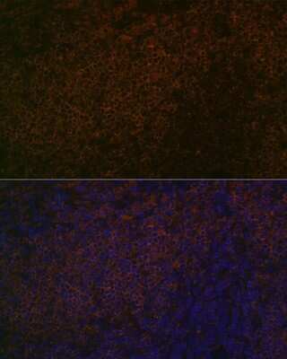 Immunohistochemistry: SHP-1 Antibody (7I1K3) [NBP3-15669]