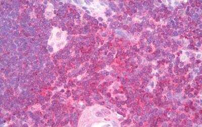 Immunohistochemistry-Paraffin: SHP-1 Antibody [NB100-58968]