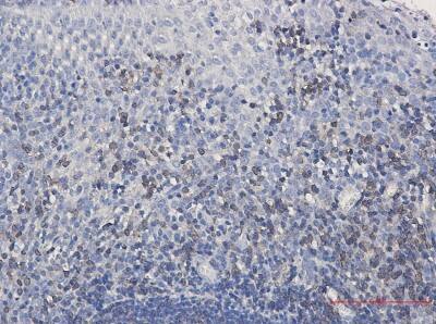 Immunohistochemistry-Paraffin: SHP-1 Antibody (S06-4C8) [NBP3-19611]