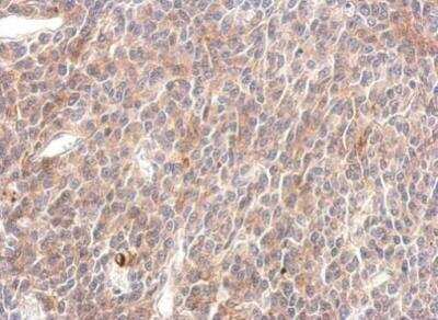 Immunohistochemistry-Paraffin: SHP-2/PTPN11 Antibody [NBP1-33064]