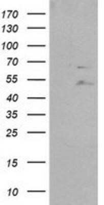 Western Blot: SHP-2/PTPN11 Antibody (OTI3F2)Azide and BSA Free [NBP2-74173]