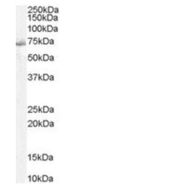 Western Blot: SHP-2/PTPN11 Antibody [NB100-806]