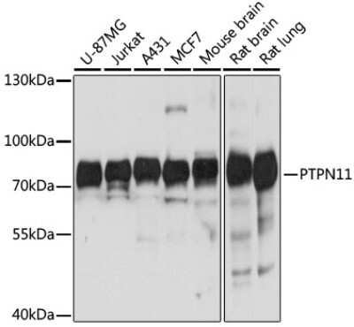 Western Blot: SHP-2/PTPN11 AntibodyAzide and BSA Free [NBP3-03486]