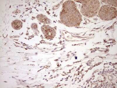 Immunohistochemistry: SHP/NR0B2/Nuclear Receptor SHP Antibody (OTI7B5) [NBP2-46522]