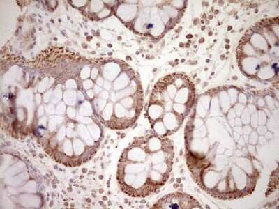 Immunohistochemistry: SHP/NR0B2/Nuclear Receptor SHP Antibody (OTI7B5) [NBP2-46522]