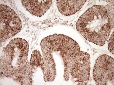 Immunohistochemistry: SHP/NR0B2/Nuclear Receptor SHP Antibody (OTI7B5) [NBP2-46522]