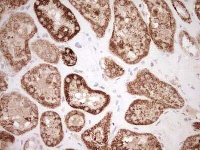 Immunohistochemistry: SHP/NR0B2/Nuclear Receptor SHP Antibody (OTI7B5) [NBP2-46522]
