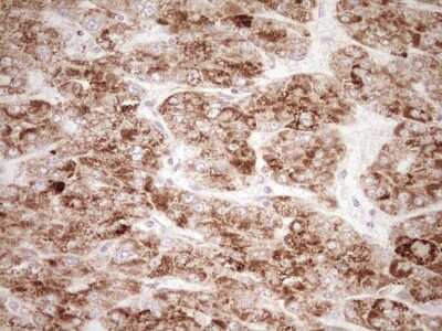 Immunohistochemistry: SHP/NR0B2/Nuclear Receptor SHP Antibody (OTI7B5) [NBP2-46522]