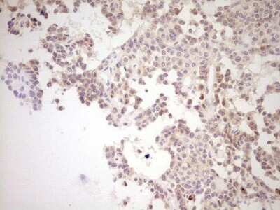 Immunohistochemistry: SHP/NR0B2/Nuclear Receptor SHP Antibody (OTI7B5) [NBP2-46522]