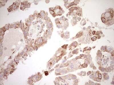 Immunohistochemistry: SHP/NR0B2/Nuclear Receptor SHP Antibody (OTI7B5) [NBP2-46522]