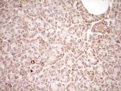Immunohistochemistry: SHP/NR0B2/Nuclear Receptor SHP Antibody (OTI7B5) [NBP2-46522]