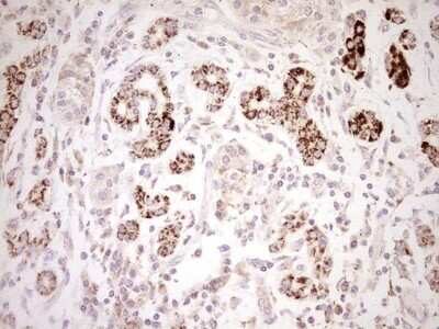 Immunohistochemistry: SHP/NR0B2/Nuclear Receptor SHP Antibody (OTI7B5) [NBP2-46522]
