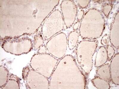Immunohistochemistry: SHP/NR0B2/Nuclear Receptor SHP Antibody (OTI7B5) [NBP2-46522]