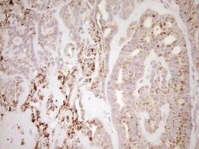 Immunohistochemistry: SHP/NR0B2/Nuclear Receptor SHP Antibody (OTI7B5) [NBP2-46522]