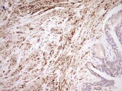 Immunohistochemistry: SHP/NR0B2/Nuclear Receptor SHP Antibody (OTI7B5) [NBP2-46522]