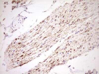Immunohistochemistry: SHP/NR0B2/Nuclear Receptor SHP Antibody (OTI7B5) [NBP2-46522]