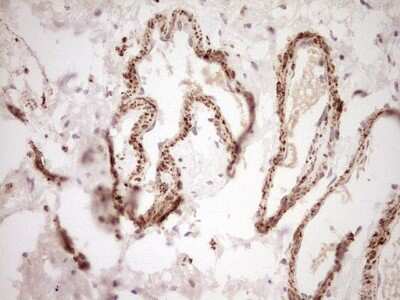 Immunohistochemistry: SHP/NR0B2/Nuclear Receptor SHP Antibody (OTI7B5) [NBP2-46522]