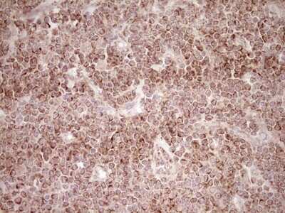 Immunohistochemistry: SHP/NR0B2/Nuclear Receptor SHP Antibody (OTI7B5) [NBP2-46522]