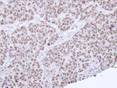 Immunohistochemistry-Paraffin: SHP/NR0B2/Nuclear Receptor SHP Antibody [NBP1-33597]