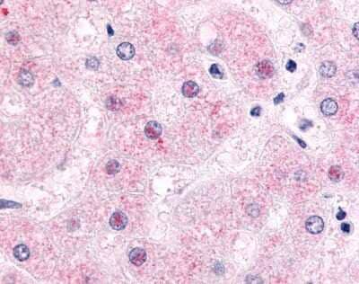 Immunohistochemistry-Paraffin: SHP/NR0B2/Nuclear Receptor SHP Antibody - BSA Free [NLS5411]