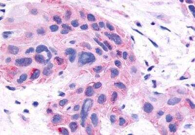 Immunohistochemistry-Paraffin: SHP/NR0B2/Nuclear Receptor SHP Antibody - BSA Free [NLS5411]