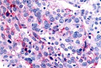 Immunohistochemistry-Paraffin: SHP/NR0B2/Nuclear Receptor SHP Antibody - BSA Free [NLS5411]