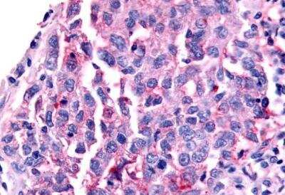 Immunohistochemistry-Paraffin: SHP/NR0B2/Nuclear Receptor SHP Antibody - BSA Free [NLS5411]