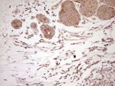 Immunohistochemistry: SHP/NR0B2/Nuclear Receptor SHP Antibody (OTI7B5) - Azide and BSA Free [NBP2-74172]