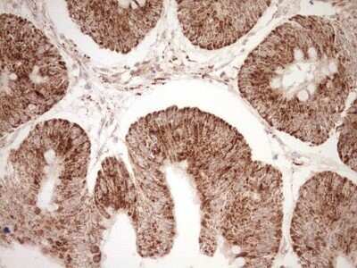 Immunohistochemistry: SHP/NR0B2/Nuclear Receptor SHP Antibody (OTI7B5) - Azide and BSA Free [NBP2-74172]