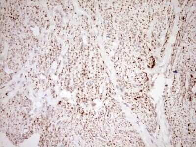 Immunohistochemistry: SHP/NR0B2/Nuclear Receptor SHP Antibody (OTI7B5) - Azide and BSA Free [NBP2-74172]