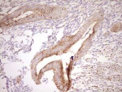 Immunohistochemistry: SHP/NR0B2/Nuclear Receptor SHP Antibody (OTI7B5) - Azide and BSA Free [NBP2-74172]