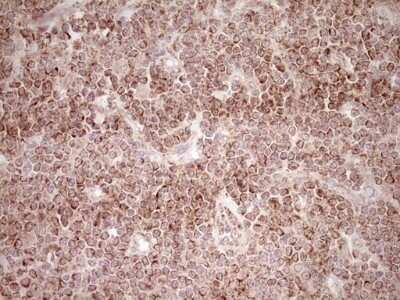 Immunohistochemistry: SHP/NR0B2/Nuclear Receptor SHP Antibody (OTI7B5) - Azide and BSA Free [NBP2-74172]