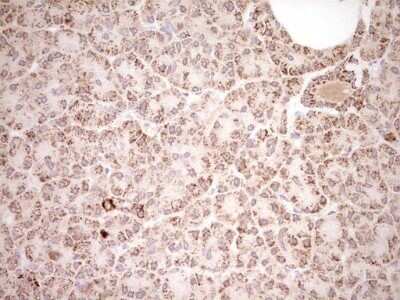 Immunohistochemistry: SHP/NR0B2/Nuclear Receptor SHP Antibody (OTI7B5) - Azide and BSA Free [NBP2-74172]