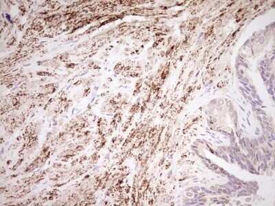 Immunohistochemistry: SHP/NR0B2/Nuclear Receptor SHP Antibody (OTI7B5) - Azide and BSA Free [NBP2-74172]