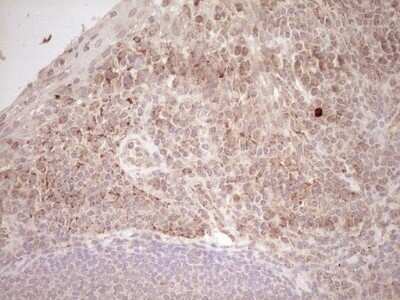 Immunohistochemistry: SHP/NR0B2/Nuclear Receptor SHP Antibody (OTI7B5) - Azide and BSA Free [NBP2-74172]