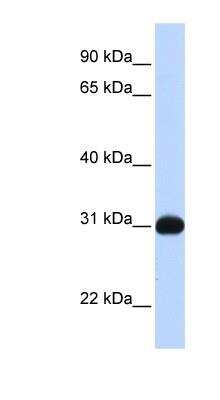 Western Blot: SHP/NR0B2/Nuclear Receptor SHP Antibody [NBP1-52816]