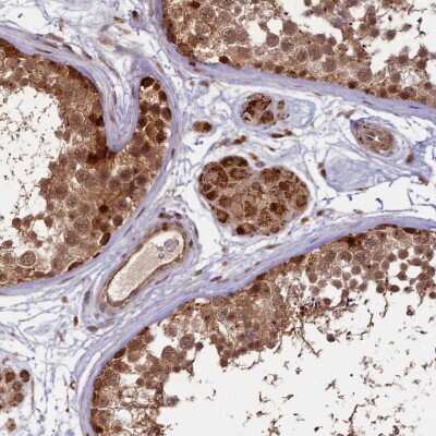 Immunohistochemistry-Paraffin: SHPRH Antibody [NBP1-92387]