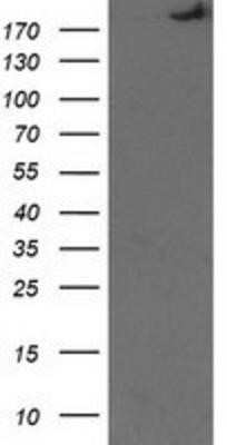 Western Blot: SHPRH Antibody (OTI5G8)Azide and BSA Free [NBP2-74180]