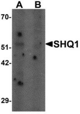 Western Blot: SHQ1 AntibodyBSA Free [NBP2-81793]