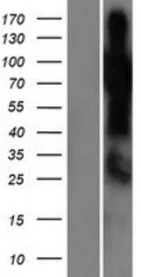 Western Blot: SHQ1 Overexpression Lysate [NBP2-06867]