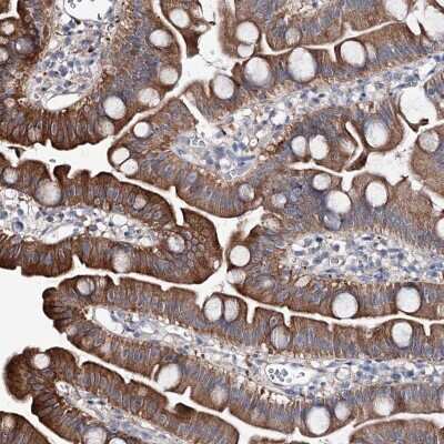 Immunohistochemistry: SHROOM1 Antibody [NBP2-32695]