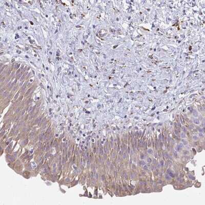 Immunohistochemistry: SHROOM1 Antibody [NBP2-32696]