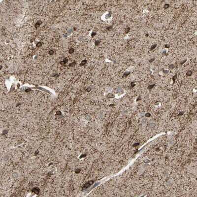 Immunohistochemistry-Paraffin: SHROOM4 Antibody [NBP1-93596]