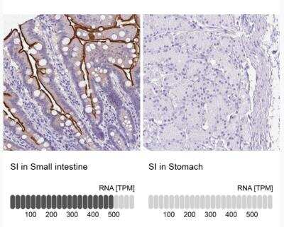 Immunohistochemistry-Paraffin: SI Sucrase-Isomaltase Antibody [NBP1-87581]