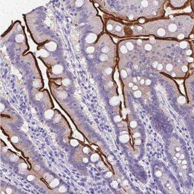 Immunohistochemistry-Paraffin: SI Sucrase-Isomaltase Antibody [NBP1-87581]
