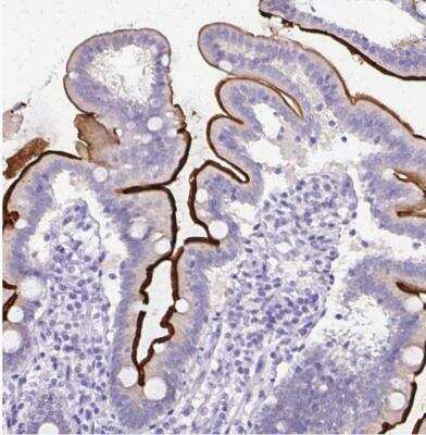 Immunohistochemistry-Paraffin: SI Sucrase-Isomaltase Antibody [NBP1-87581]