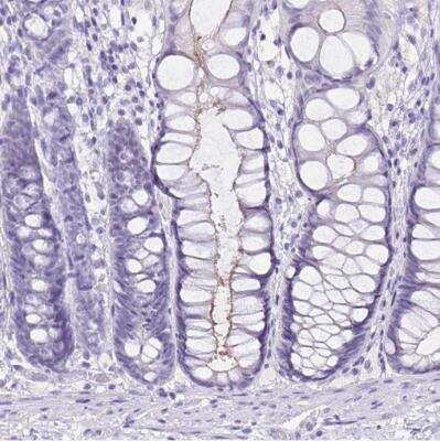 Immunohistochemistry-Paraffin: SI Sucrase-Isomaltase Antibody [NBP1-87581]