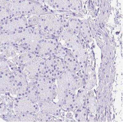 Immunohistochemistry-Paraffin: SI Sucrase-Isomaltase Antibody [NBP1-87581]