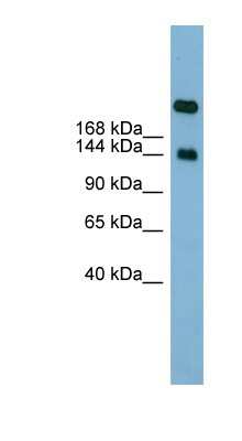 Western Blot: SI Sucrase-Isomaltase Antibody [NBP1-62362]